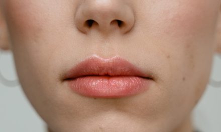 Get the look with lip fillers Harley Street  